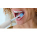 Насадка для зубної щітки Philips Sonicare HX9044/87 C3 Premium Plaque Defense